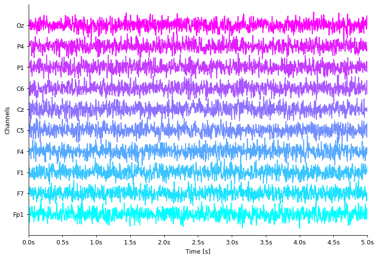 ../_images/notebooks_03-eeg_10_0.png