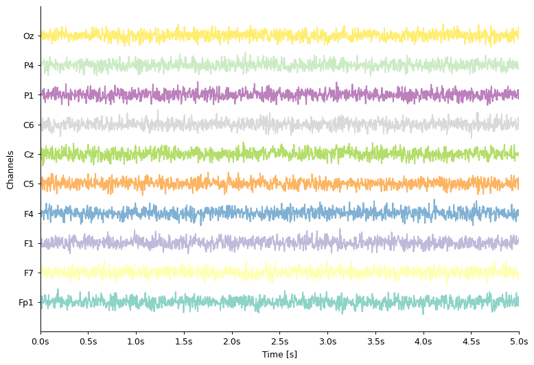 ../_images/notebooks_03-eeg_11_0.png