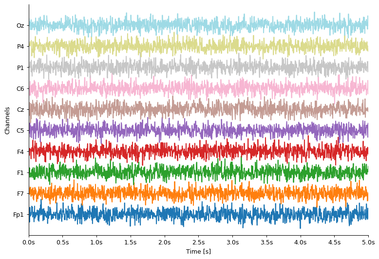 ../_images/notebooks_03-eeg_12_0.png