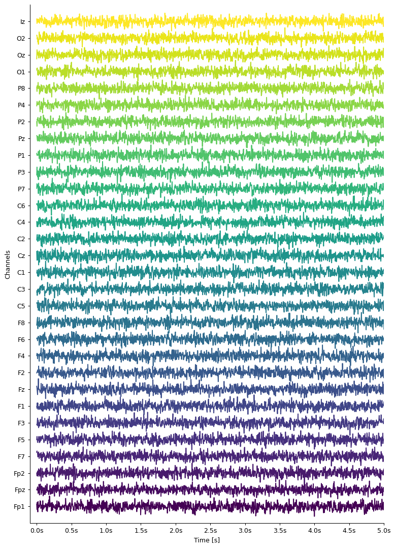 ../_images/notebooks_03-eeg_8_0.png